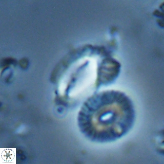 Helicosphaera tenebriscornus 27617