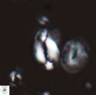 Helicosphaera tenebriscornus 27610