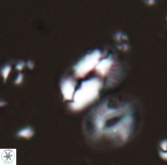 Helicosphaera tenebriscornus 27611