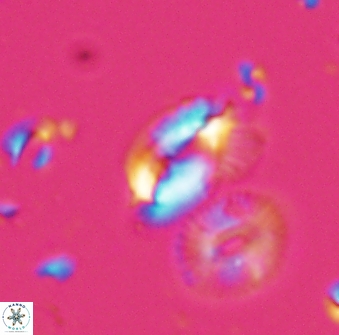 Helicosphaera tenebriscornus 27612