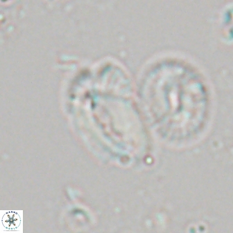 Helicosphaera tenebriscornus 27613