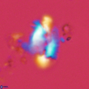 Helicosphaera treisporoi VR 05524