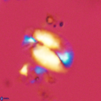 Helicosphaera treisporoi VR 05525