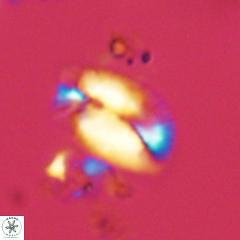 Helicosphaera treisporoi VR 05525