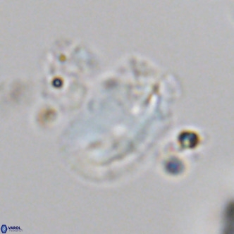 Helicosphaera treisporoi VR 05530