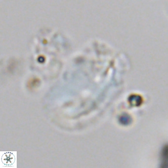 Helicosphaera treisporoi VR 05530