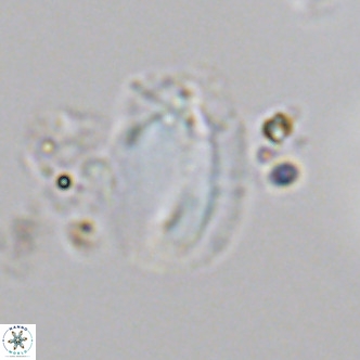 Helicosphaera treisporoi VR 05531