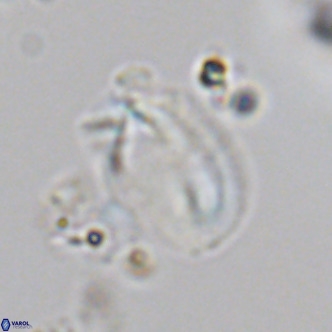 Helicosphaera treisporoi VR 05532