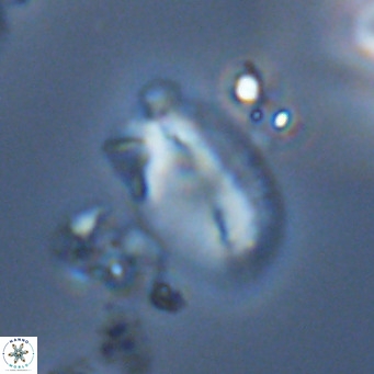 Helicosphaera treisporoi VR 05533