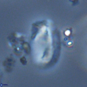 Helicosphaera treisporoi VR 05534