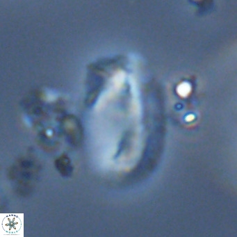 Helicosphaera treisporoi VR 05534