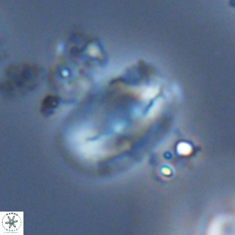 Helicosphaera treisporoi VR 05535