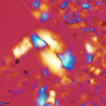 Helicosphaera treisporoi VR 05577