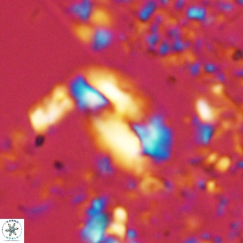 Helicosphaera treisporoi VR 05577