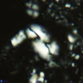 Helicosphaera treisporoi VR 05578