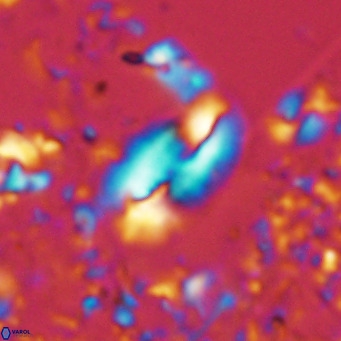 Helicosphaera treisporoi VR 05580