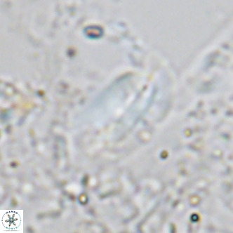 Helicosphaera treisporoi VR 05581