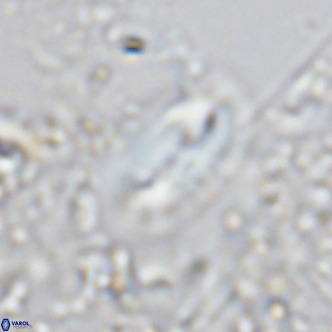 Helicosphaera treisporoi VR 05582