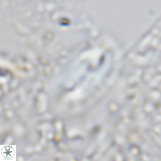 Helicosphaera treisporoi VR 05582