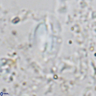 Helicosphaera treisporoi VR 05583