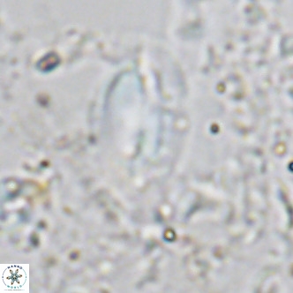 Helicosphaera treisporoi VR 05583