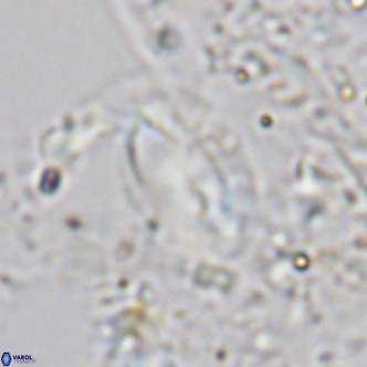 Helicosphaera treisporoi VR 05584