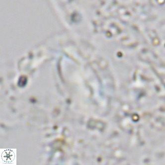 Helicosphaera treisporoi VR 05584
