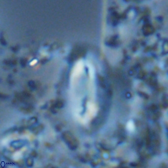 Helicosphaera treisporoi VR 05586