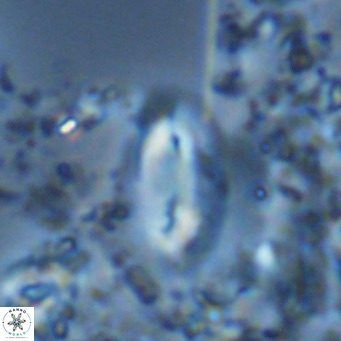 Helicosphaera treisporoi VR 05586