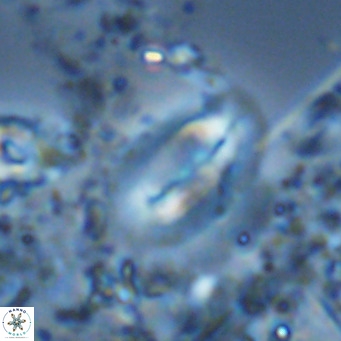 Helicosphaera treisporoi VR 05588