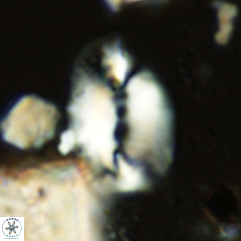 Helicosphaera treisporoi VR 05304