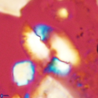 Helicosphaera treisporoi VR 05307