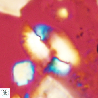 Helicosphaera treisporoi VR 05307