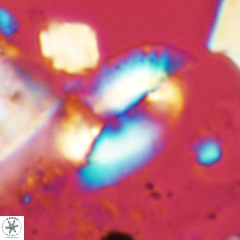 Helicosphaera treisporoi VR 05308