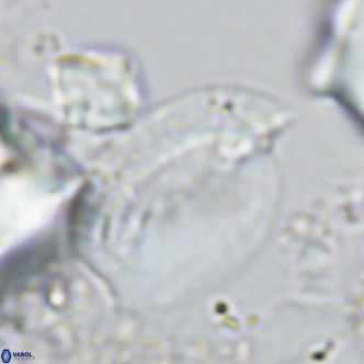 Helicosphaera treisporoi VR 05310