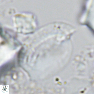 Helicosphaera treisporoi VR 05310