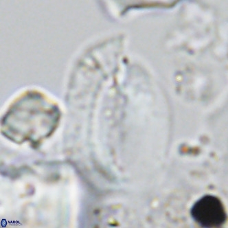 Helicosphaera treisporoi VR 05311