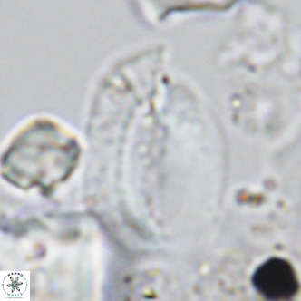 Helicosphaera treisporoi VR 05311
