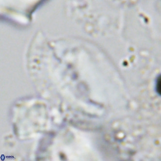 Helicosphaera treisporoi VR 05312