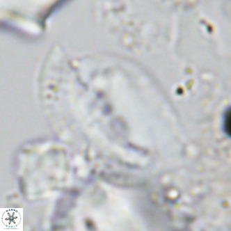Helicosphaera treisporoi VR 05312