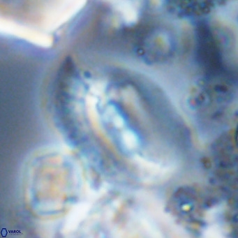 Helicosphaera treisporoi VR 05314