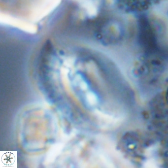 Helicosphaera treisporoi VR 05314