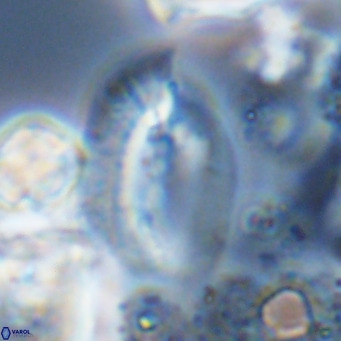 Helicosphaera treisporoi VR 05315