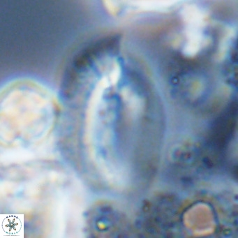 Helicosphaera treisporoi VR 05315