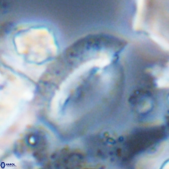 Helicosphaera treisporoi VR 05316