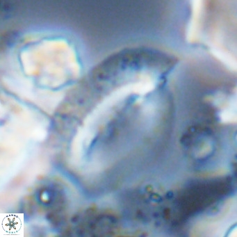 Helicosphaera treisporoi VR 05316
