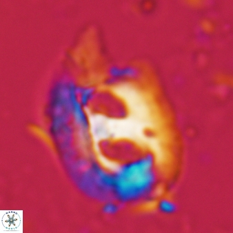 Helicosphaera truncata 361