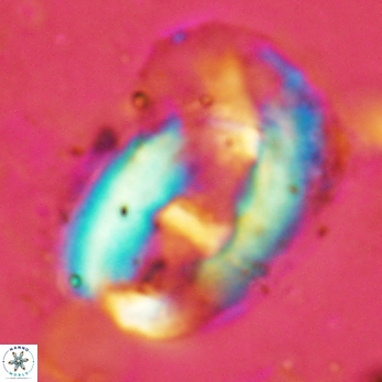 Helicosphaera truempyi 2418