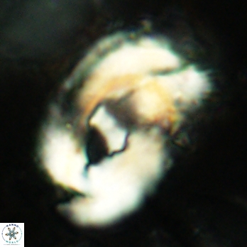 Helicosphaera truempyi 2430