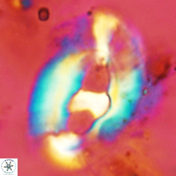 Helicosphaera truempyi 2445